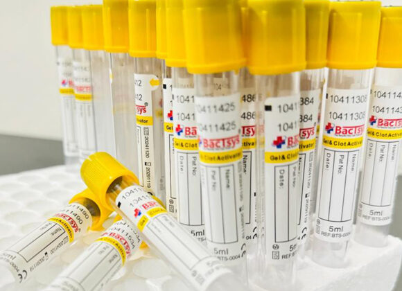 Clinical Research and Trials Clinical Research and Trials