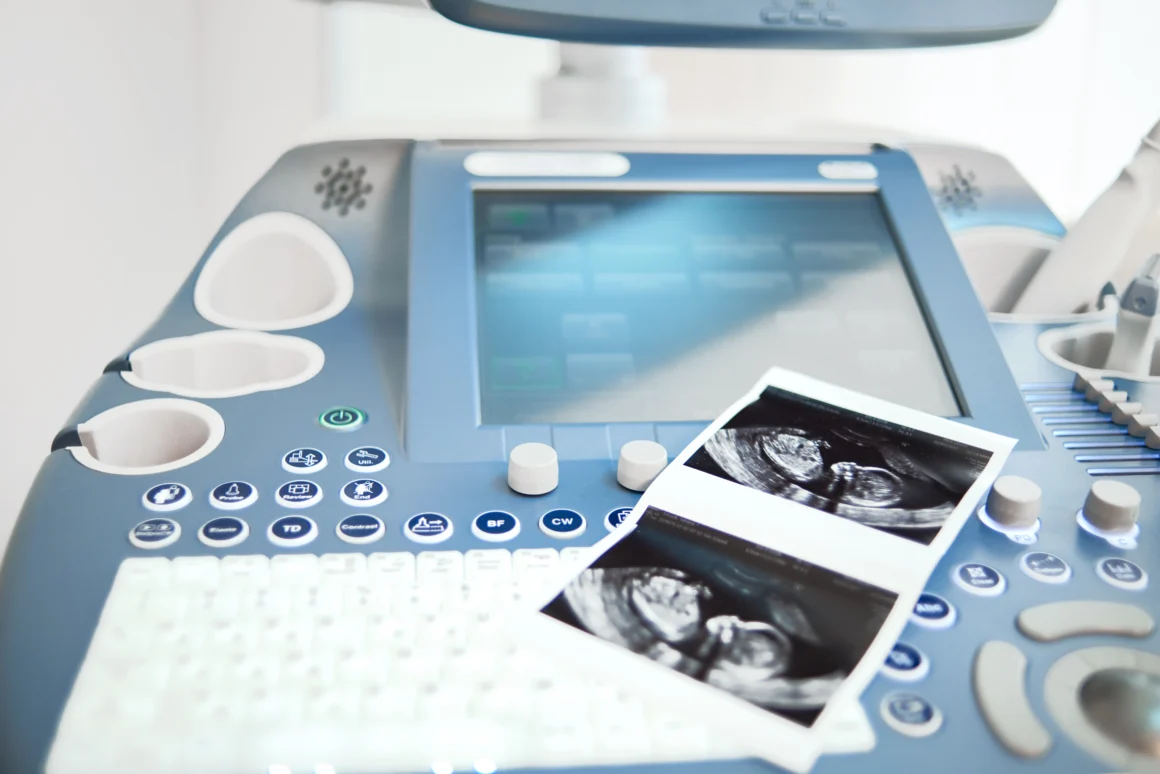 ultrasound-scanning-machine-clinic Advanced Diagnostic Technologies