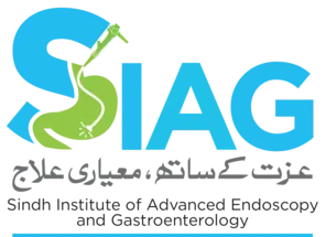 SIAG